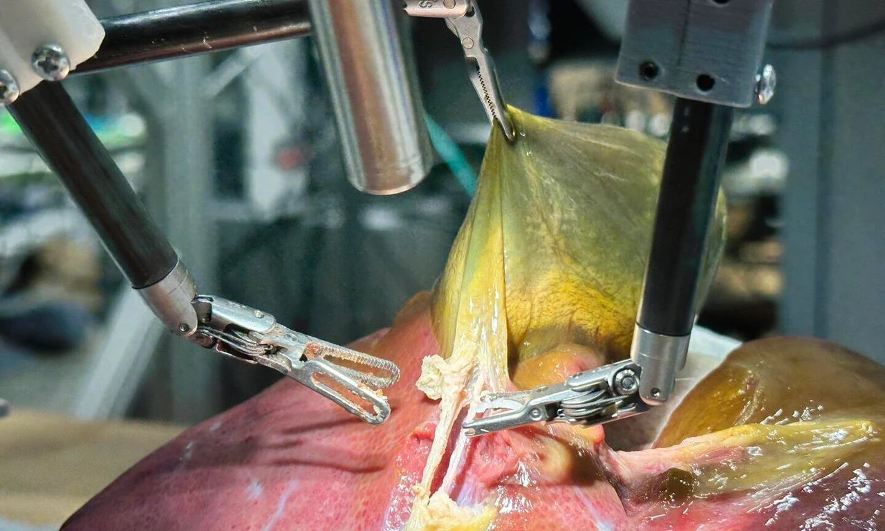 Robosurgeon performs first non-human gallbladder removal surgery