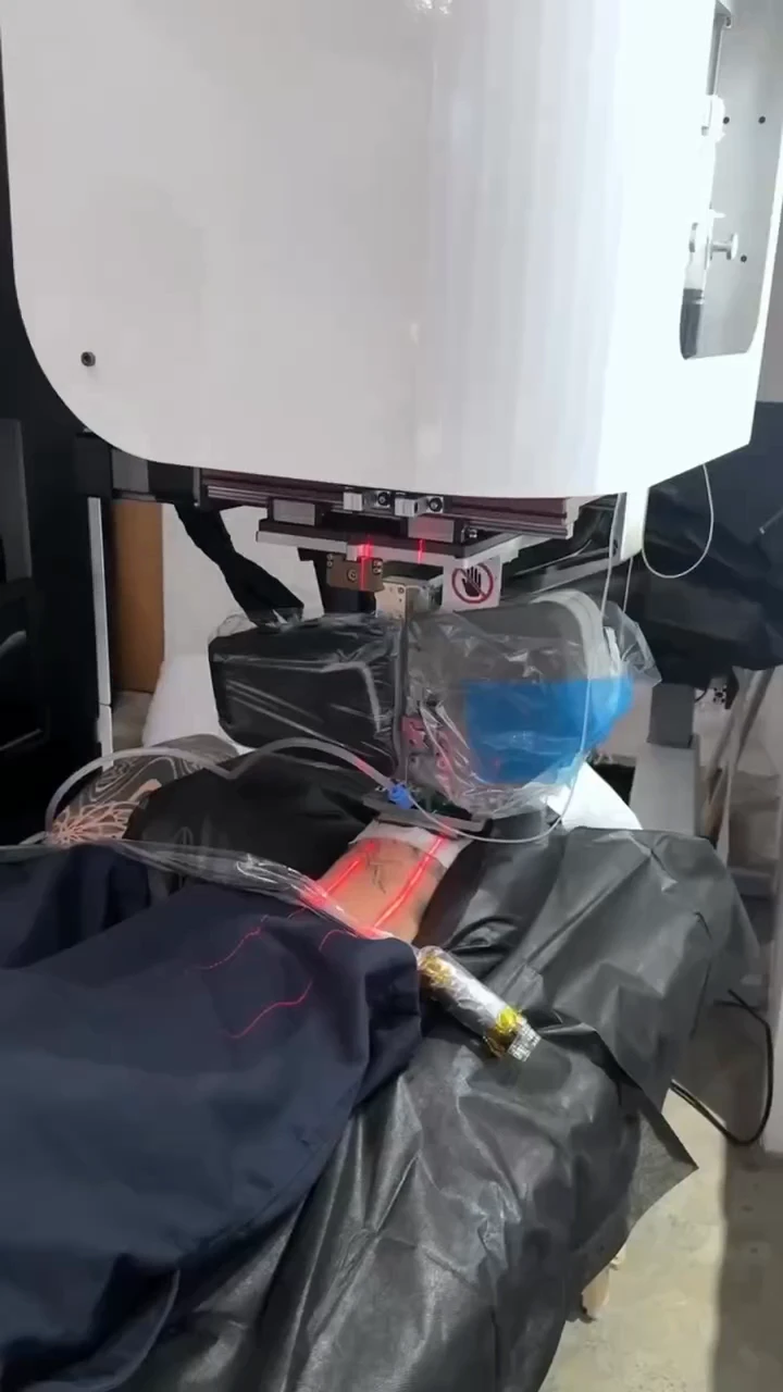 Tattooing Meets Robotics – Blackdot Brings AI Precision to Body Art