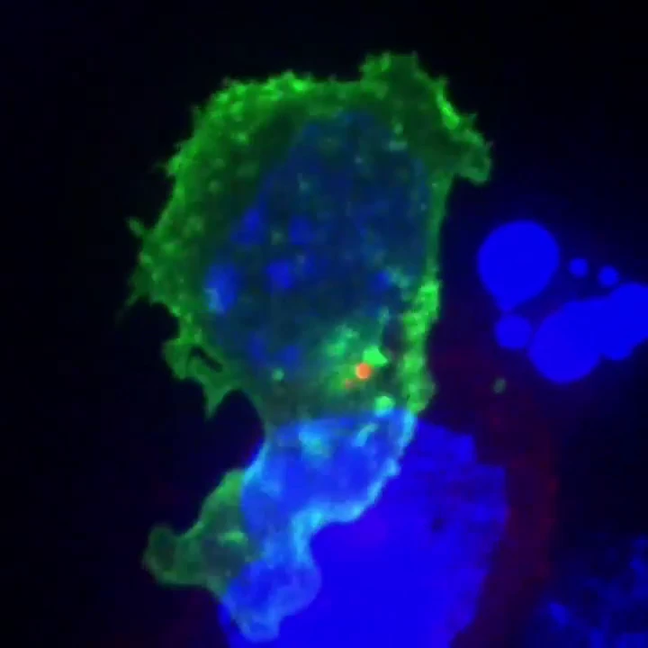 AI is involved in cancer treatment