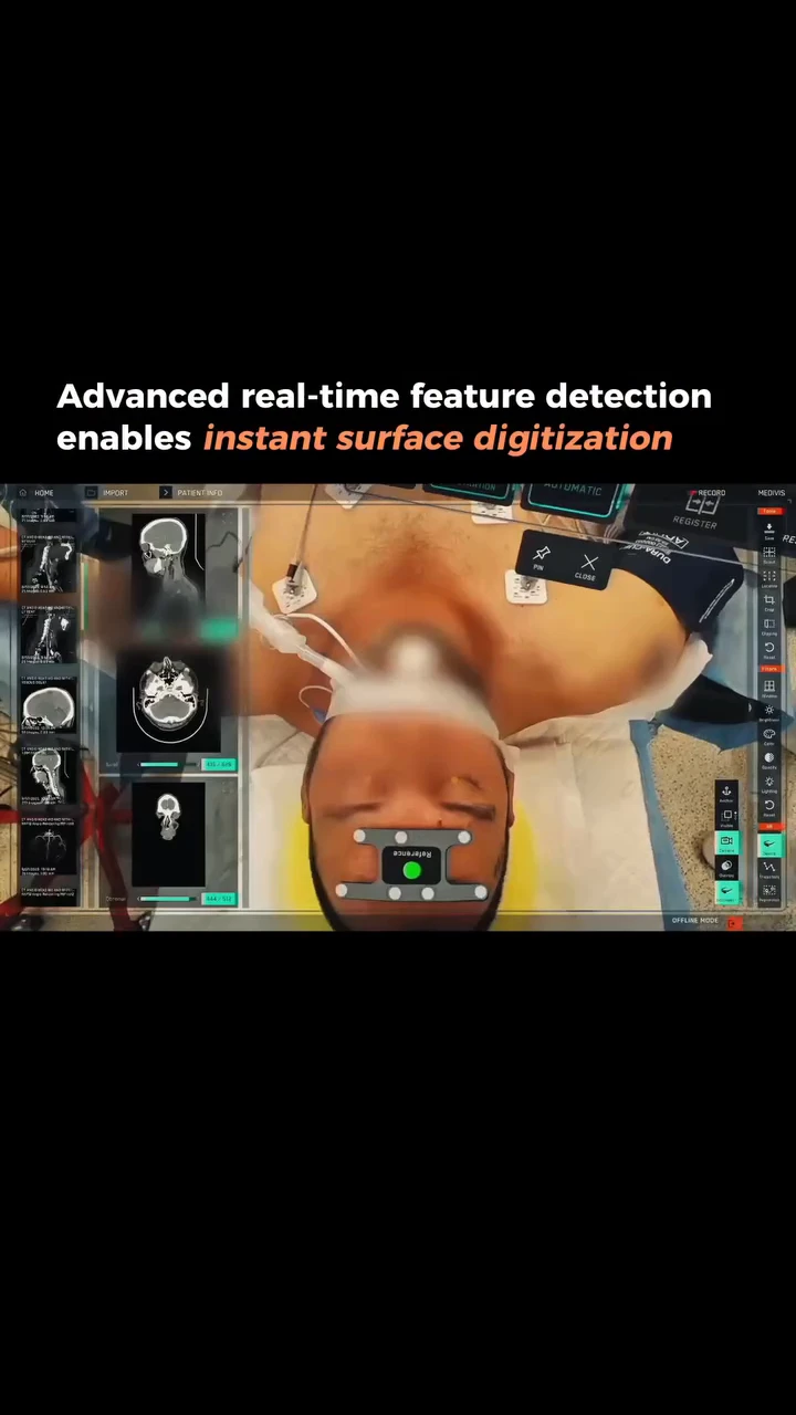 Advanced Real-Time Feature Detection Enables Instant Surface Digitization