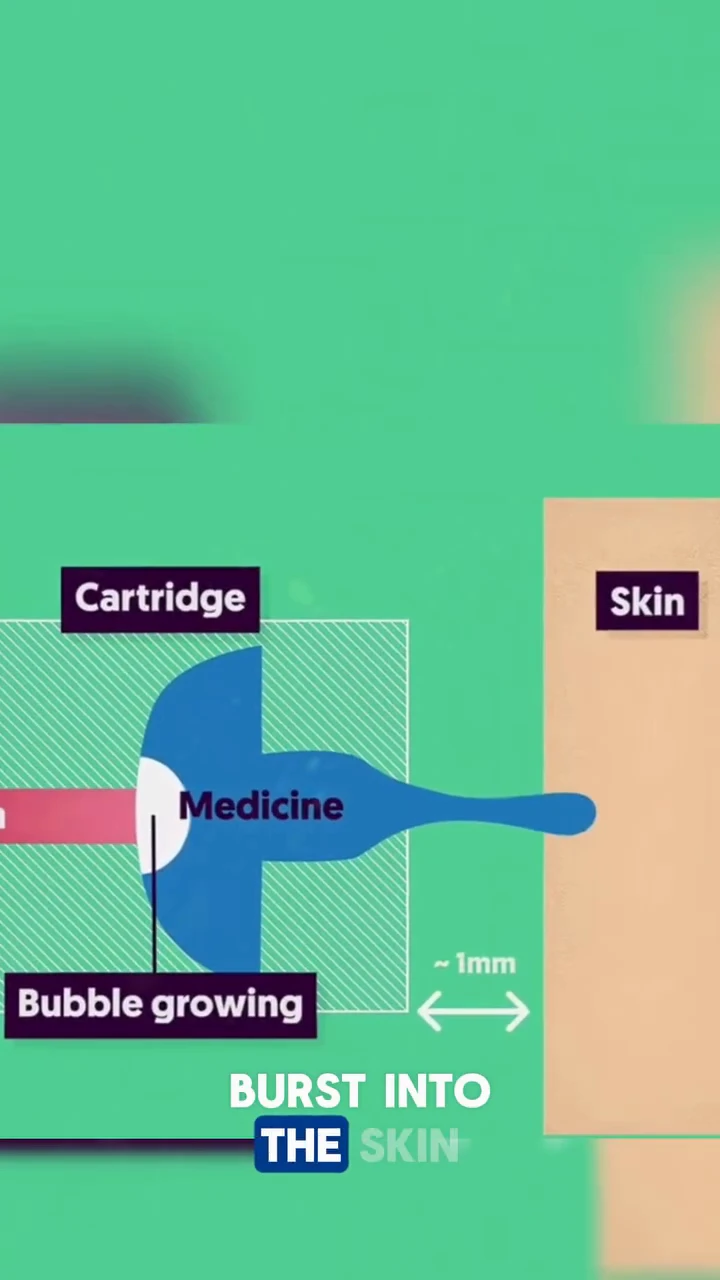 Needle-Free Injection
